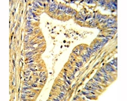 Anti-Superoxide Dismutase 1 Antibody (SOD1)