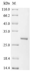 ATP-dependent DNA helicase Q5 (RECQL5), partial, human, recombinant