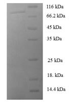 Muscle, skeletal receptor tyrosine-protein kinase (MUSK),partial, human, recombinant