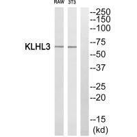 Anti-KLHL3
