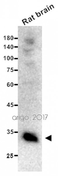 Anti-CDK4, clone 3F9-B12-C8