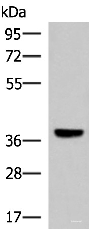 Anti-LRG1