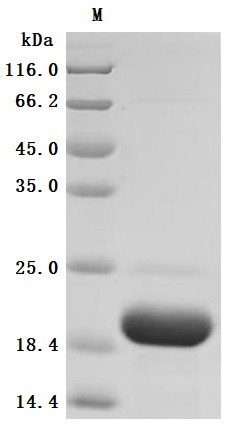 Kidney-associated antigen 1(KAAG1) (Active), human, recombinant