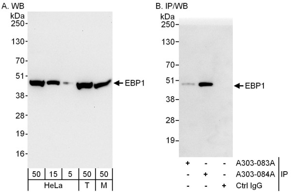 Anti-EBP1