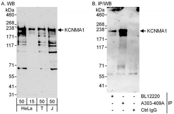 Anti-KCNMA1