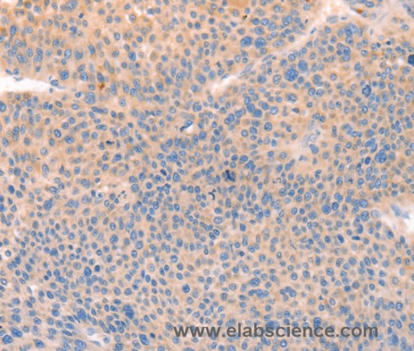 Anti-CD109
