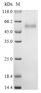 Envelopment polyprotein (GP), partial, Hantaan virus, recombinant