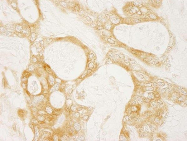 Anti-Diaphanous 1 (IHC)