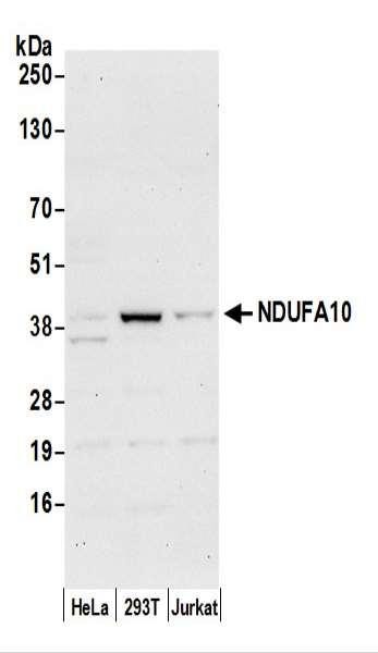 Anti-NDUFA10