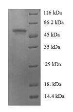 Na (+)/H (+) exchange regulatory cofactor NHE-RF3 (PDZK1), human, recombinant