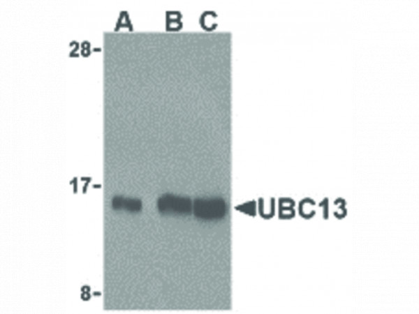 Anti-UBC13