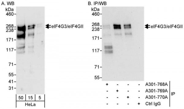 Anti-eIF4G3/eIF4GII