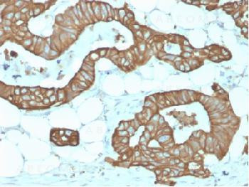 Anti-Cytokeratin 19 (KRT19) (Pancreatic Stem Cell Marker) Recombinant Rabbit Monoclonal Antibody (cl