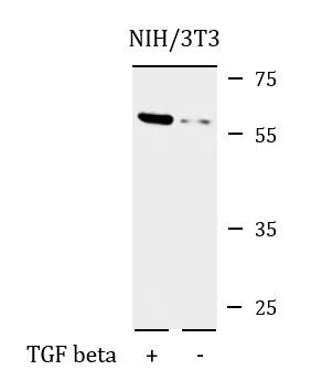 Anti-phospho-Smad 4 (Thr276)