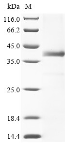 DNA cross-link repair 1A protein (DCLRE1A), partial, human, recombinant