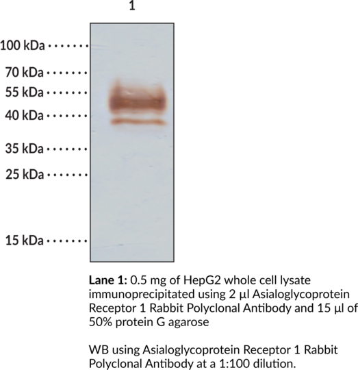 Anti-Asialoglycoprotein Receptor 1 Rabbit