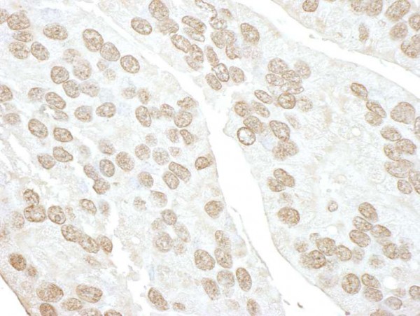 Anti-POLR3D (IHC)