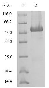 Sorcin (SRI), human, recombinant