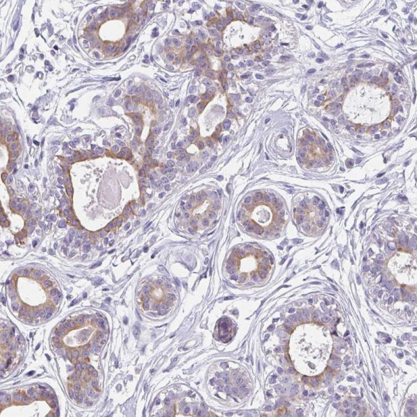 Anti-C1QTNF8