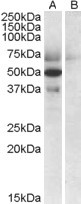 Anti-Apolipoprotein L4, C-terminal