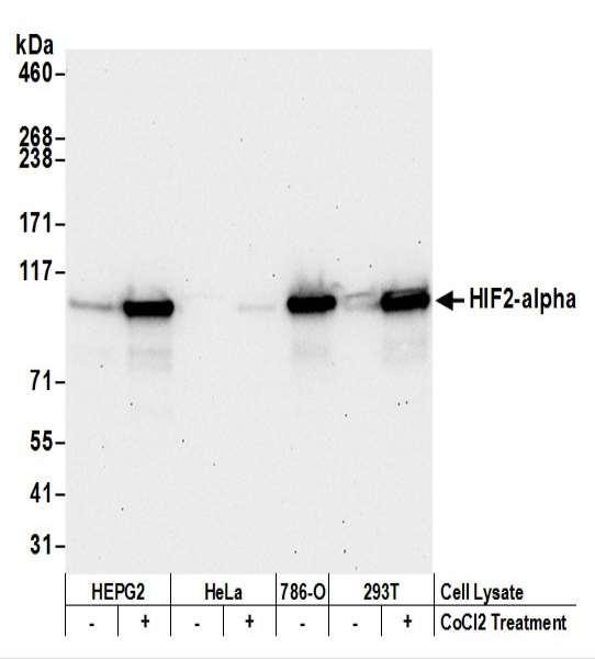 Anti-HIF2-alpha Recombinant Monoclonal