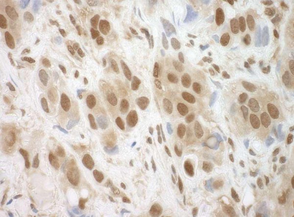 Anti-BRCC36 (IHC)
