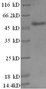 Zinc finger BED domain-containing protein 1 (ZBED1), partial, human, recombinant