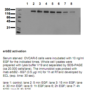 Anti-phospho-ErbB2 (Tyr1248), clone 6G7