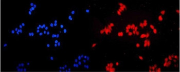 Anti-ETV5 / ETS Translocation Variant 5