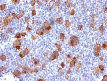 Anti-CD30 / TNFRSF8 (Hodgkin &amp; Reed-Sternberg Cell Marker) (clone: Ki-1/1747R) (recombinant rabbit m