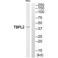 Anti-TBPL2