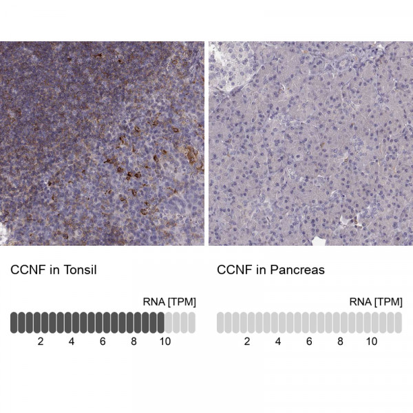 Anti-CCNF