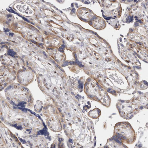 Anti-TIMM17B