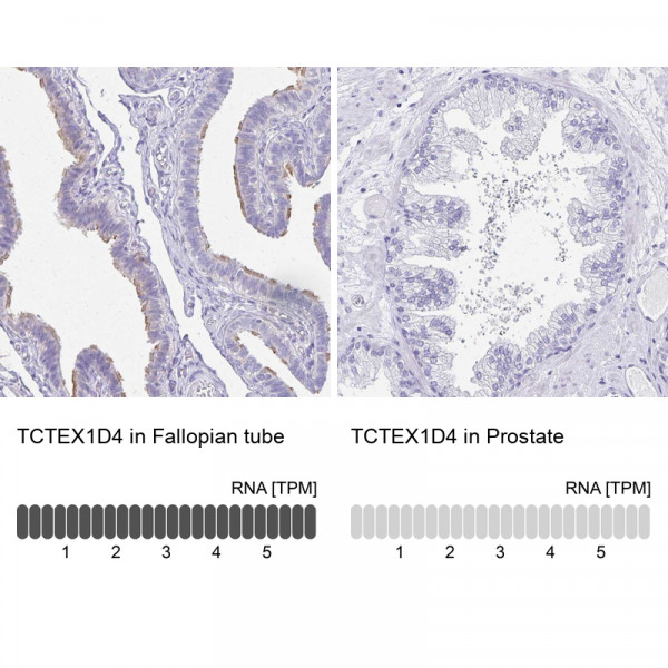Anti-TCTEX1D4