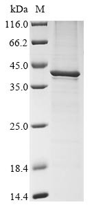 Major capsid protein VP1, Murine polyomavirus, recombinant