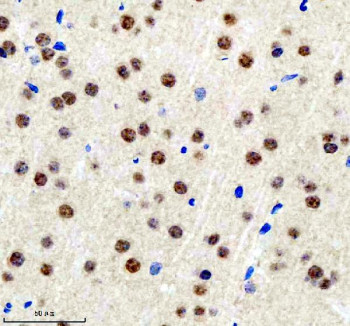 Anti-BCLAF1 / Bcl-2-associated transcription factor 1