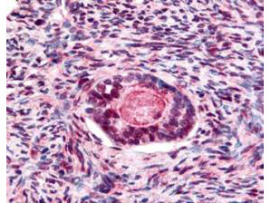 Anti-phospho-Glycogen Synthase Kinase-3 beta (Ser9) (GSK3b)