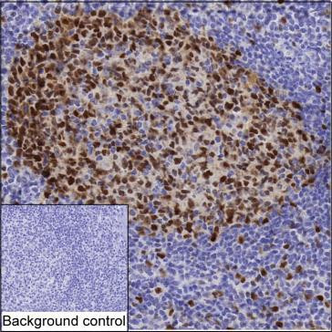 Anti-PCNA