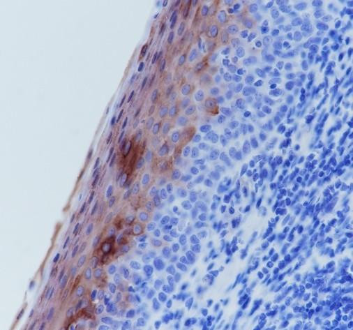 Anti-Recombinant Keratin 4, clone A278