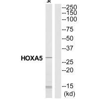 Anti-HOXA5