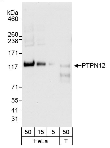 Anti-PTPN12