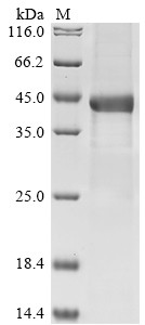Complement factor H-related protein 1 (CFHR1), partial, human, recombinant