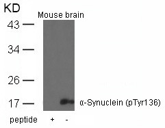 Anti-phospho-alpha Synuclein (Tyr136)