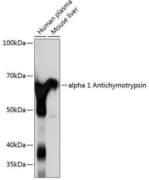 Anti-Alpha-1 Antichymotrypsin (SERPINA3)