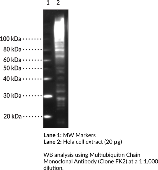 Anti-Multiubiquitin Chain (Clone FK2)