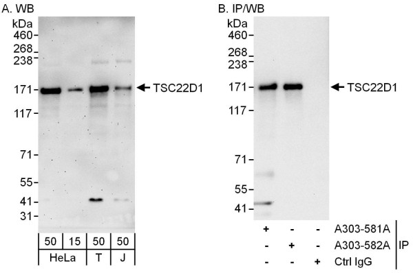 Anti-TSC22D1