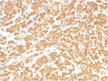 Anti-ICOS-L / ICOS Ligand / B7RP-1, clone ICOSL/3260