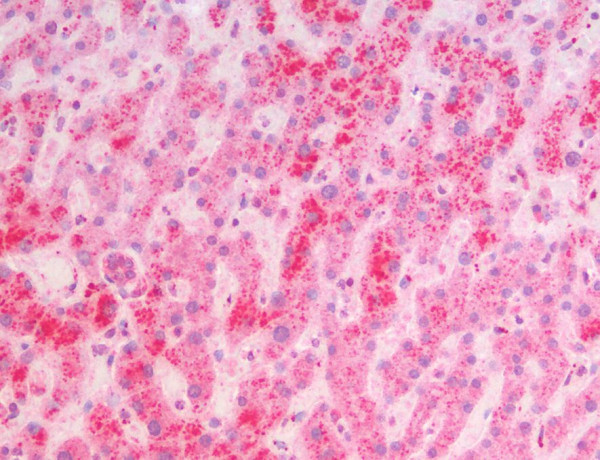 Anti-MSI2 / Musashi 2