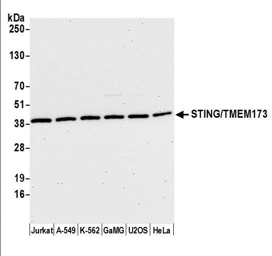 Anti-STING/TMEM173