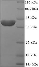 Ras-related protein Rab-2A (RAB2A), human, recombinant